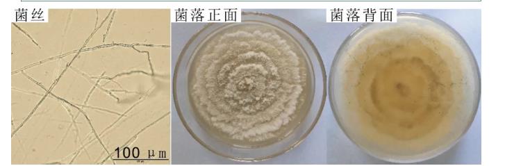 柑桔砂皮病菌座殼菌生長條件及納米藥劑篩選（一）