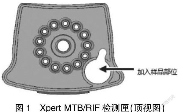 臨床結核分枝桿菌體外藥敏試驗：分子DST檢測VS表型DST藥敏診斷技術（一）