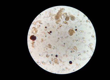 ?土壤中有哪些微生物？土壤微生物在生態(tài)系統(tǒng)中的作用
